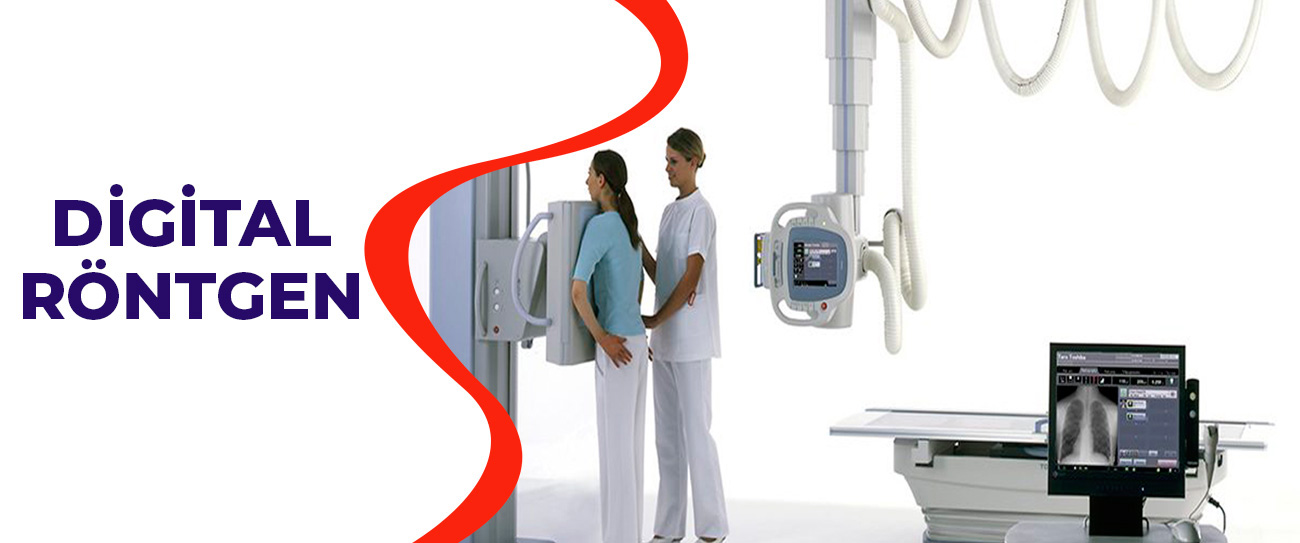 dijital röntgen